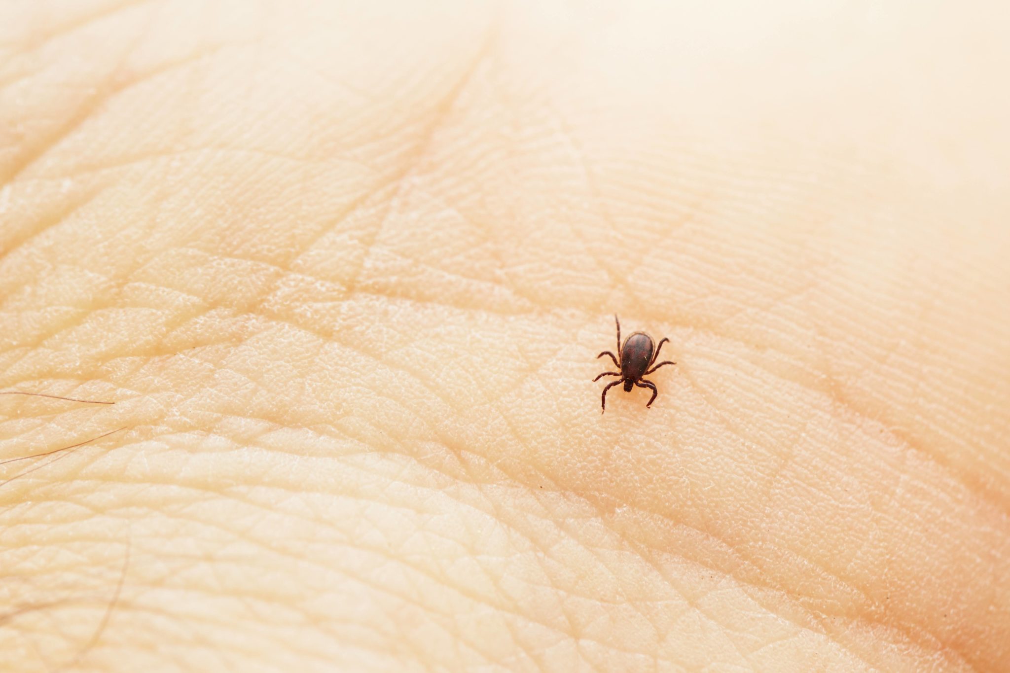 Tick, deer tick, lyme disease