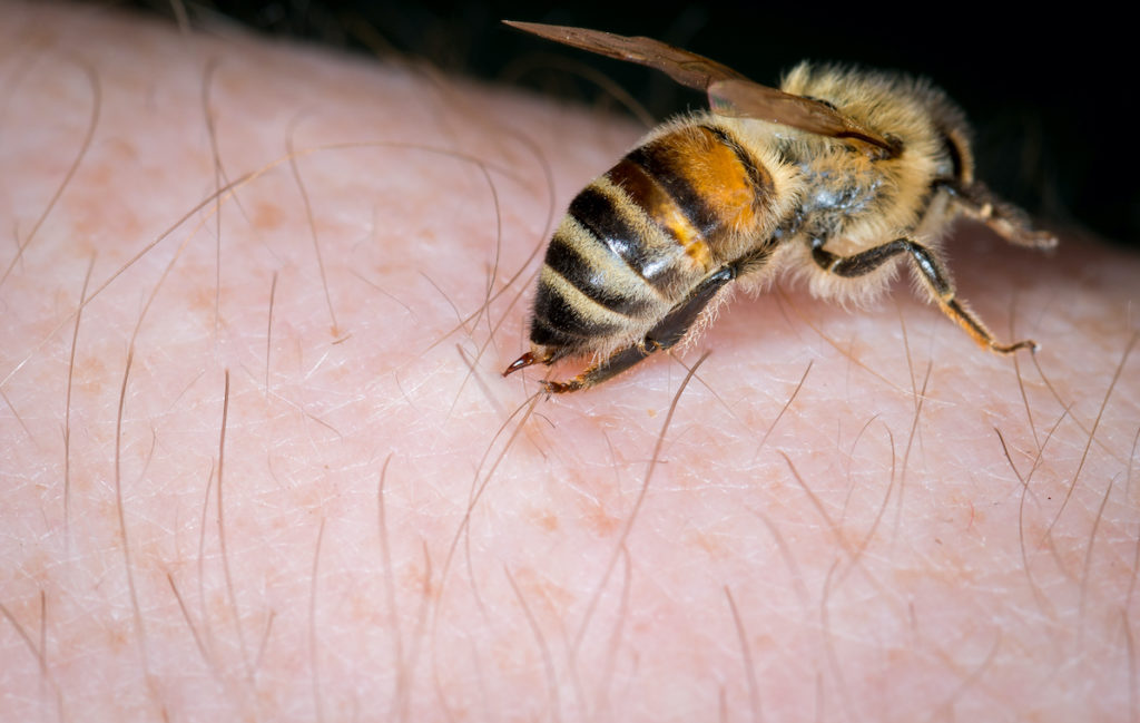 Bee stinging a human